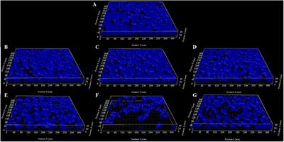 Influence of High Intensity Focused Ultrasound on the Microstructure and c-di-GMP Signaling of Pseudomonas aeruginosa Biofilms